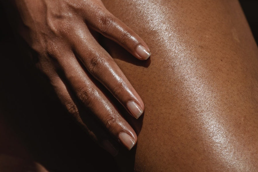 Stretch Marks After Pregnancy Are Not Embarrassing